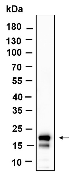 Recombinant Histone H3 (Acetyl Lys18) Monoclonal Antibody (AGEL6107)
