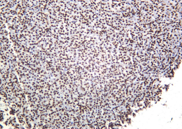Recombinant Histone H3 (Di Methyl Lys79) Monoclonal Antibody (AGEL6111)