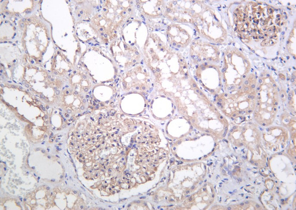 Recombinant TXNIP Monoclonal Antibody (AGEL6117)