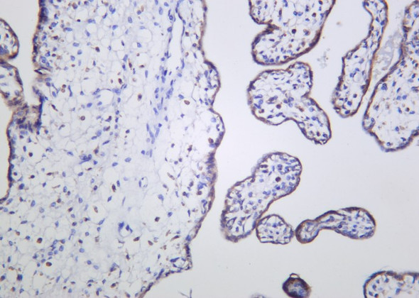 Recombinant STK3 Monoclonal Antibody (AGEL6119)