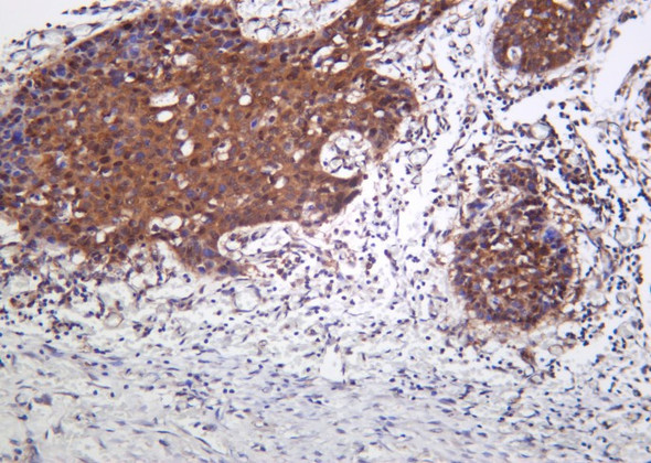 Recombinant PAKγ Monoclonal Antibody (AGEL6121)