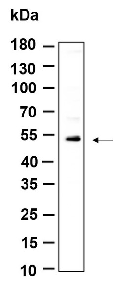 Recombinant KRTHB3 Monoclonal Antibody (AGEL6124)