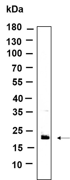 Recombinant RAB7B Monoclonal Antibody (AGEL6148)