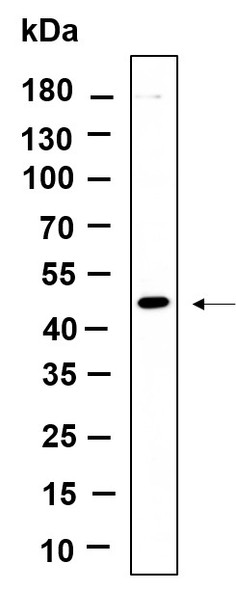Recombinant DPS1 Monoclonal Antibody (AGEL6150)