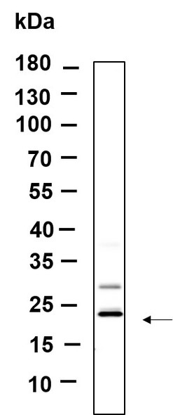 Recombinant KLLN Monoclonal Antibody (AGEL6153)