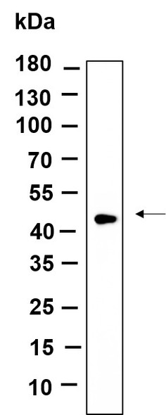 Recombinant TPST2 Monoclonal Antibody (AGEL6155)