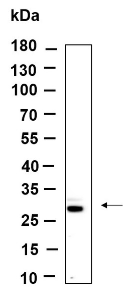 Recombinant FRAT1 Monoclonal Antibody (AGEL6158)