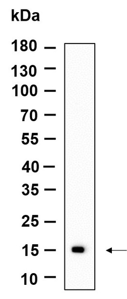 Recombinant CLEC2B Monoclonal Antibody (AGEL6164)