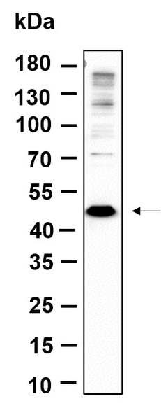 Recombinant Methionyl Aminopeptidase 1 Monoclonal Antibody (AGEL6168)