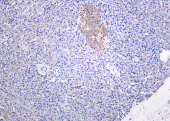 Recombinant Musashi-1 Monoclonal Antibody (AGEL6172)
