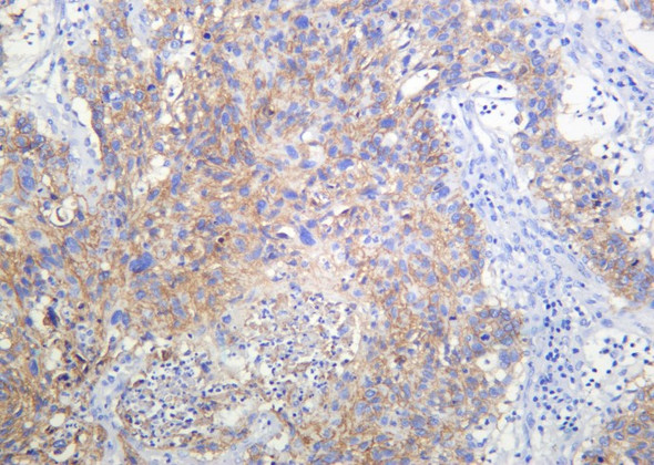 Recombinant RSK3 Monoclonal Antibody (AGEL6174)