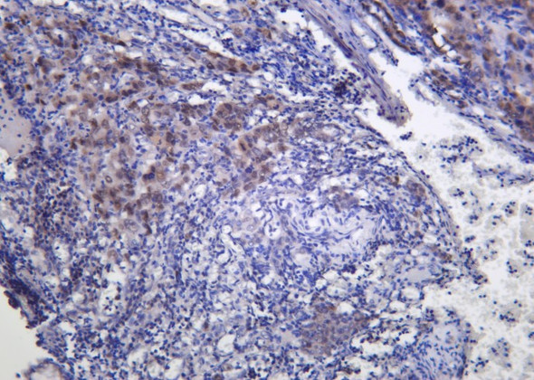 Recombinant FRA1 Monoclonal Antibody (AGEL6176)