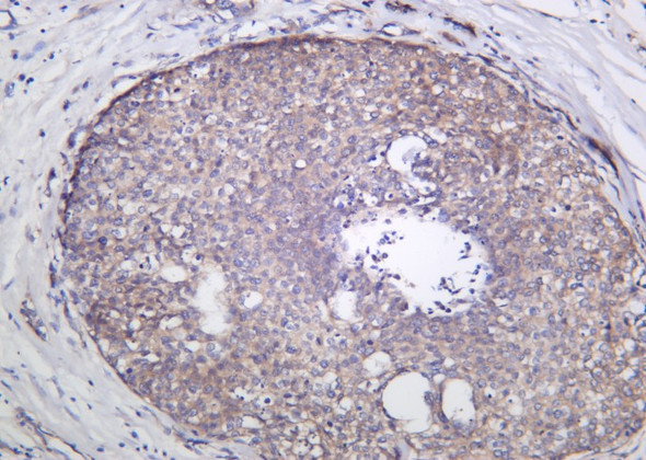 Recombinant GCN2 Monoclonal Antibody (AGEL6179)