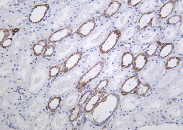 Recombinant HXK I Monoclonal Antibody (AGEL6185)