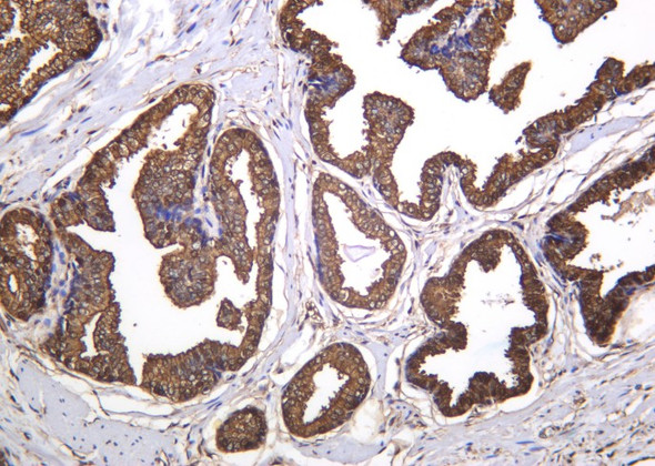 Recombinant ANXA5 Monoclonal Antibody (AGEL6189)