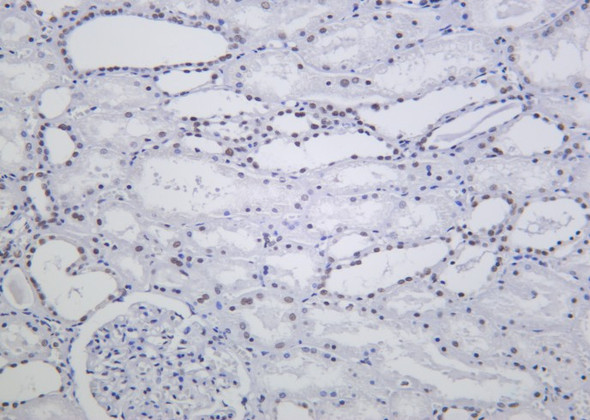 Recombinant ARID1A Monoclonal Antibody (AGEL6190)