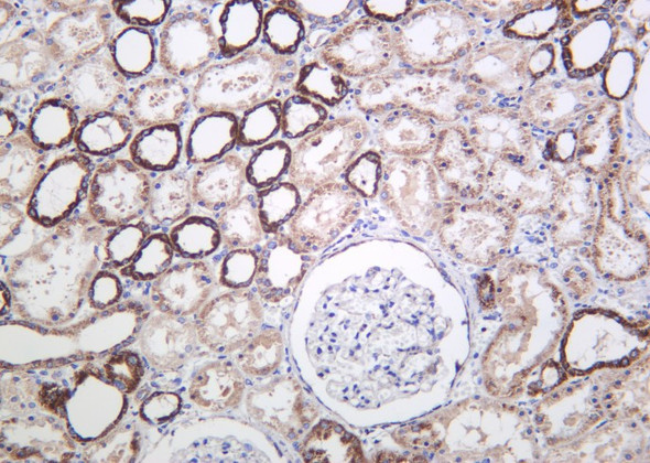 Recombinant Cyclophilin F Monoclonal Antibody (AGEL6192)