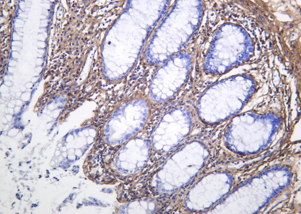Recombinant Collagen VI Monoclonal Antibody (AGEL6198)