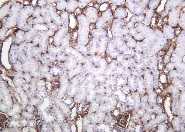 Recombinant Annexin II Monoclonal Antibody (AGEL6199)