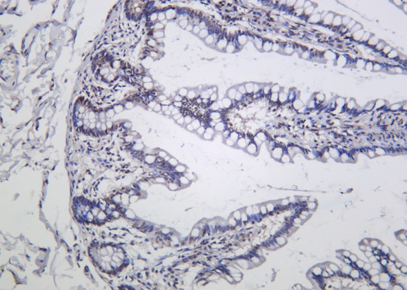 Recombinant Phospho-IκB-α (Ser36) Monoclonal Antibody (AGEL6209)