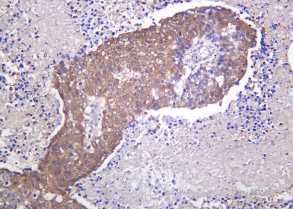 Recombinant PARK7 Monoclonal Antibody (AGEL6214)