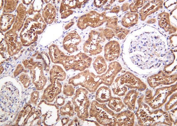 Recombinant PGK1 Monoclonal Antibody (AGEL6215)