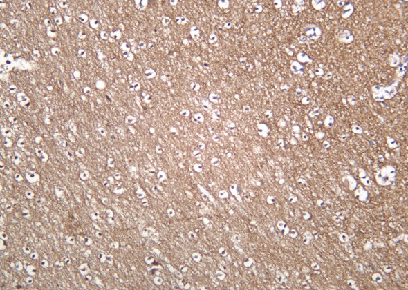 Recombinant Trk A Monoclonal Antibody (AGEL6216)