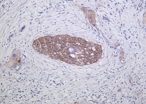 Recombinant Integrin α2 Monoclonal Antibody (AGEL6220)