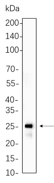 Recombinant HSP27 Monoclonal Antibody (AGEL6239)