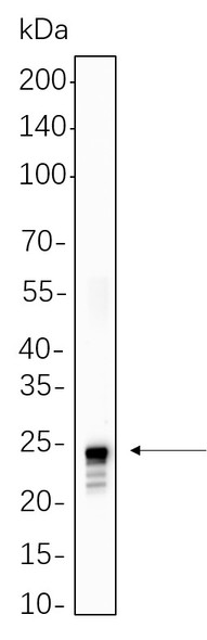 Recombinant Histone H2A (Ubiquityl Lys119) Monoclonal Antibody (AGEL6255)