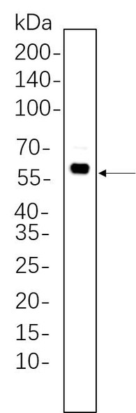 Recombinant Phospho-Akt (Thr308) Monoclonal Antibody (AGEL6259)