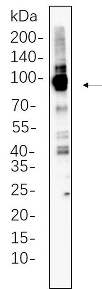 Recombinant Calnexin Monoclonal Antibody (AGEL6260)