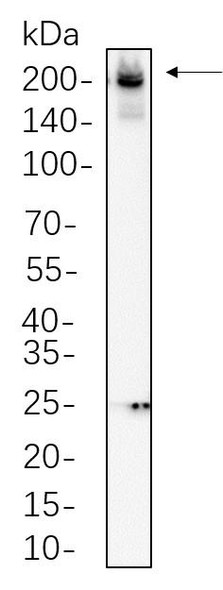 Recombinant Collagen II Monoclonal Antibody (AGEL6264)