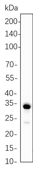 Recombinant Calponin-1 Monoclonal Antibody (AGEL6270)