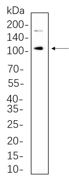 Recombinant IRE1α Monoclonal Antibody (AGEL6273)
