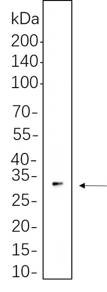 Recombinant TWIST1 Monoclonal Antibody (AGEL6277)