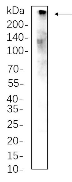 Recombinant CREBBP Monoclonal Antibody (AGEL6281)