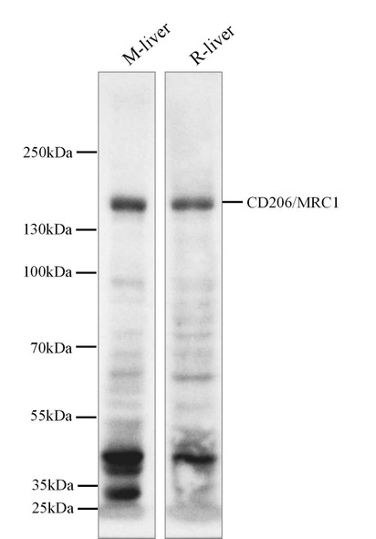 Recombinant CD206/MRC1 Monoclonal Antibody (AGEL6282)