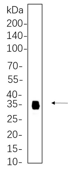 Recombinant Slug Monoclonal Antibody (AGEL6284)