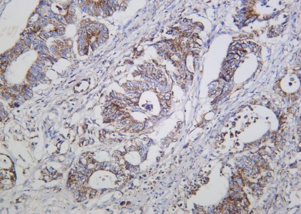 Recombinant Cleaved Caspase-3 (Asp175) Monoclonal Antibody (AGEL6288)