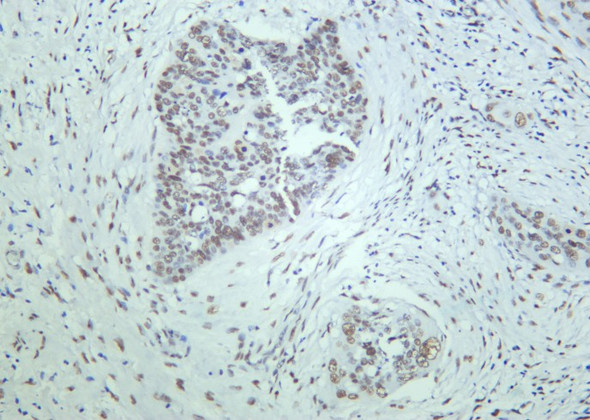 Recombinant 53BP1 Monoclonal Antibody (AGEL6298)