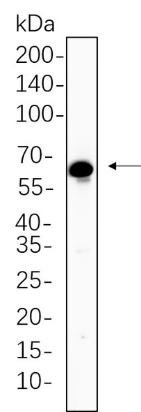 Recombinant TGF β Receptor II Monoclonal Antibody (AGEL6302)