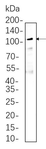 Recombinant MMP9 Monoclonal Antibody (AGEL6307)