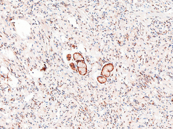 Recombinant SQSTM1/p62 Monoclonal Antibody (AGEL6312)