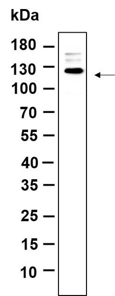 Recombinant Rb Monoclonal Antibody (AGEL6316)