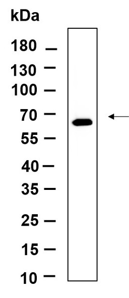 Recombinant Phospho-PERK (Thr980) Monoclonal Antibody (AGEL6317)
