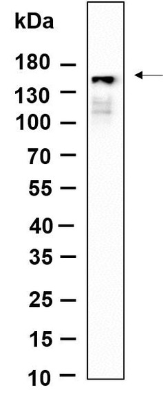 Recombinant Phospho-PLCγ1 (Tyr783) Monoclonal Antibody (AGEL6319)