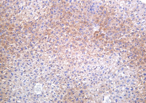 Recombinant Phospho-Acetyl-CoA Carboxylase (Ser79) Monoclonal Antibody (AGEL6320)