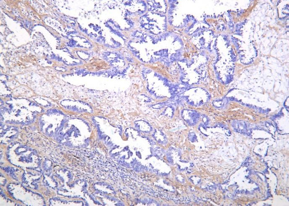Recombinant SREBP-1 Monoclonal Antibody (AGEL6327)