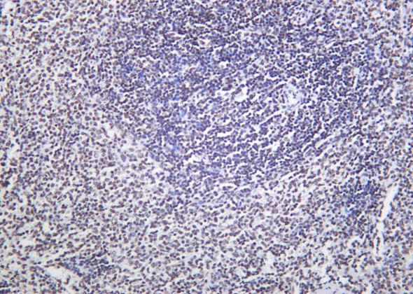 Recombinant Phospho-Rpb1 (Ser2) Monoclonal Antibody (AGEL6328)